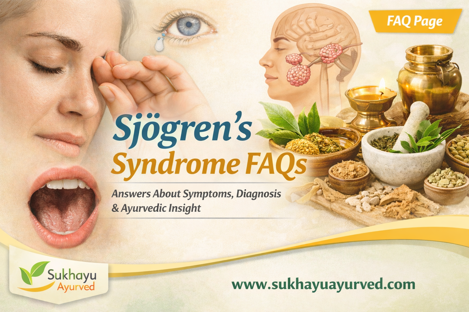 Sjögren’s Syndrome — Questions Patients Commonly Ask (A Practical FAQ Guide)