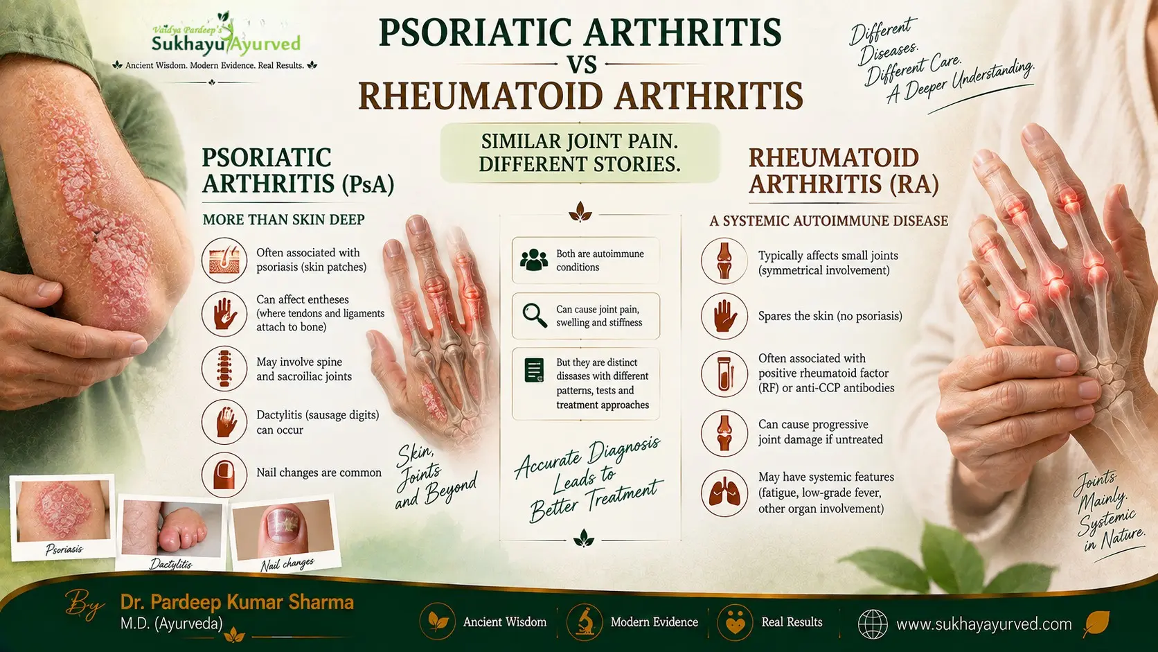 Psoriatic Arthritis vs Rheumatoid Arthritis: How I Tell Them Apart in Clinic