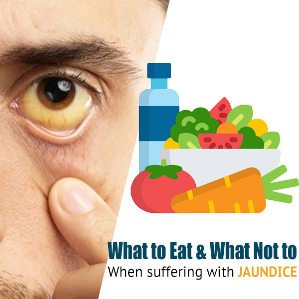 Diet for jaundice patients