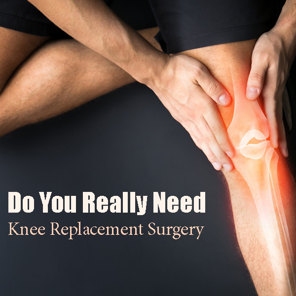 do you need knee replacement