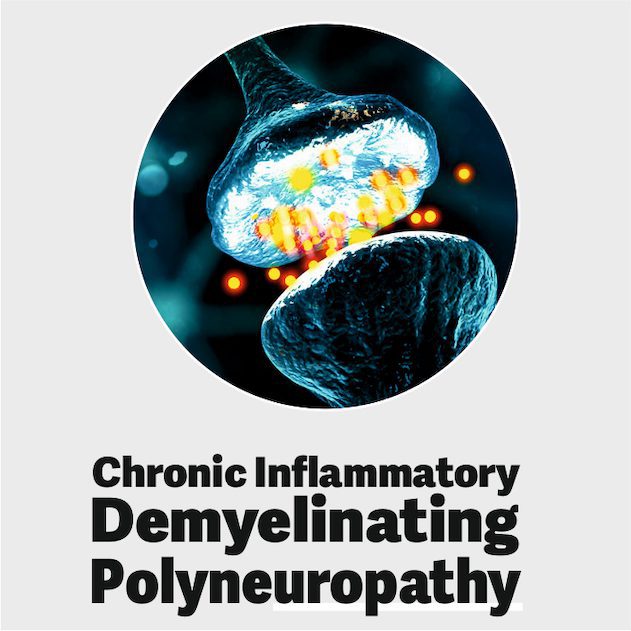 Chronic Inflammatory demyelinating polyneuropathy: Ayurvedic Cure