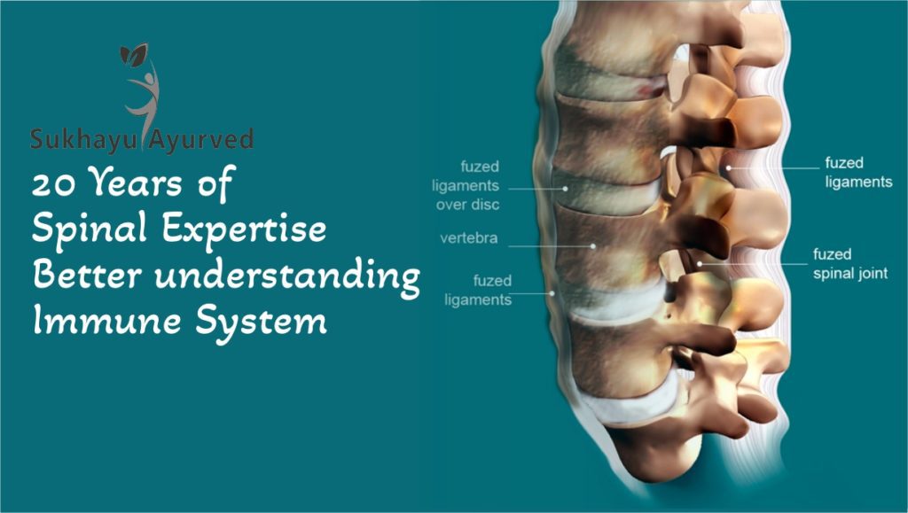 Ankylosing spondylitis treatment in Ayurveda