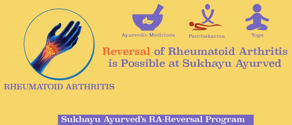 Ayurvedic treatment for Rheumatoid arthritis