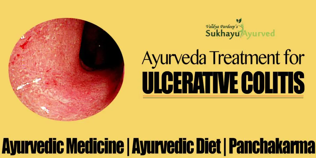 Ayurvedic Treatment for Ulcerative Colitis