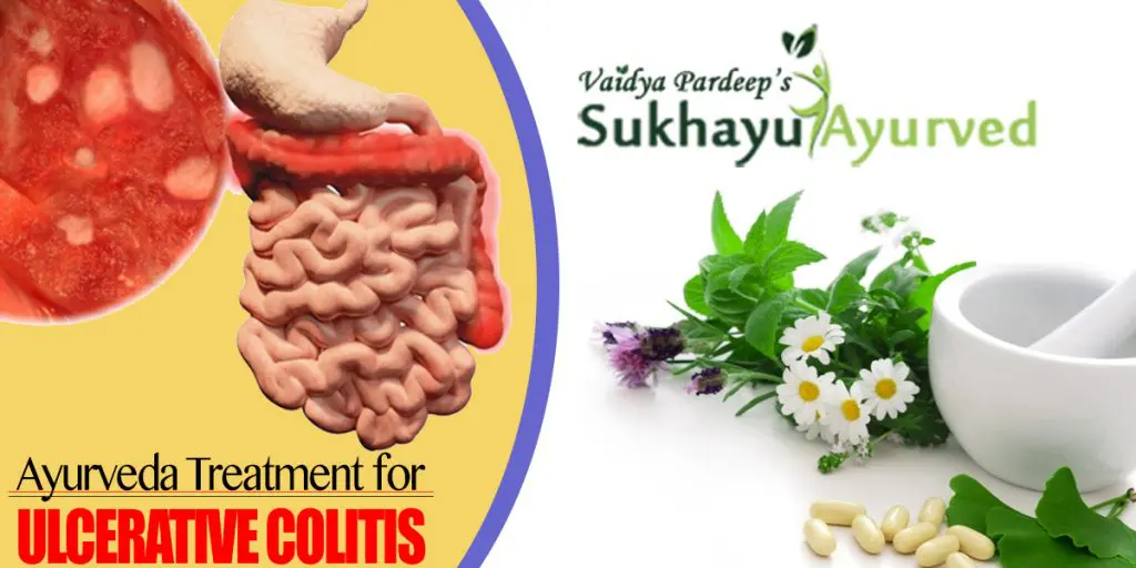 Ayurvedic Treatment for Ulcerative Colitis