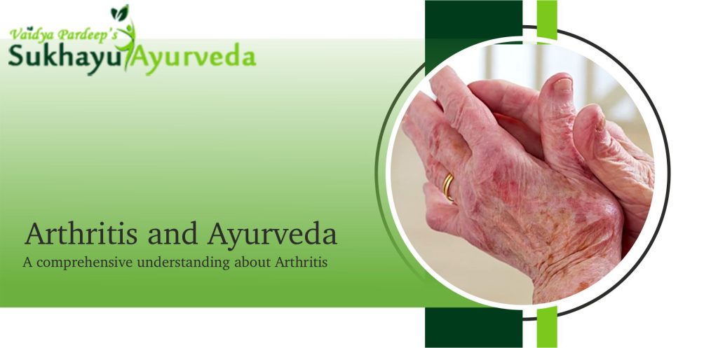 Arthritis and Ayurveda