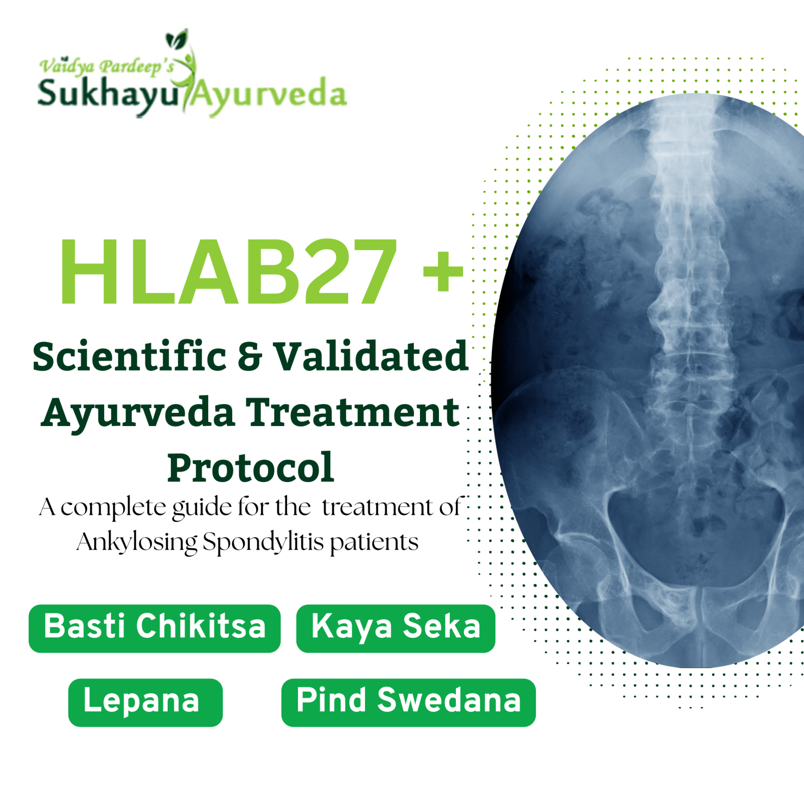 Ankylosing Spondylitis Ayurveda treatment protocol