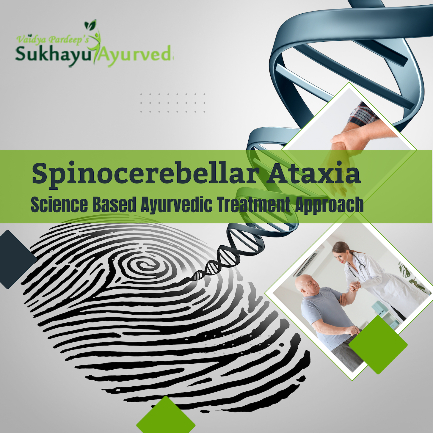 SCA case study
